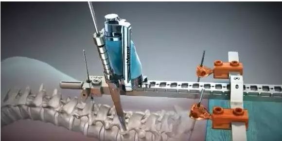 老齡化社會下的醫(yī)療設備需求